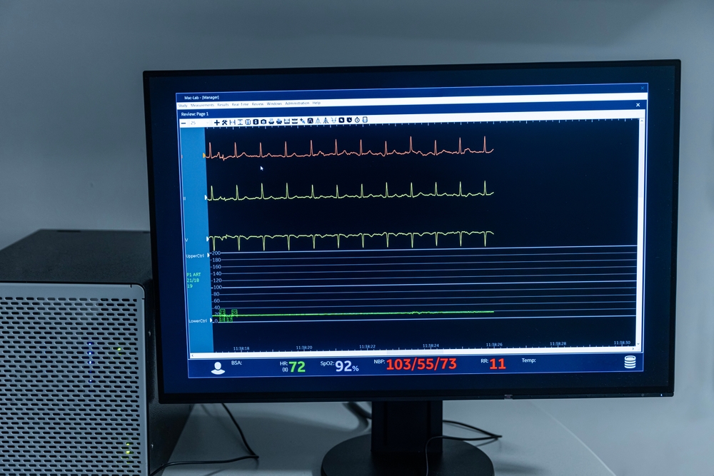 Cardiogram signal