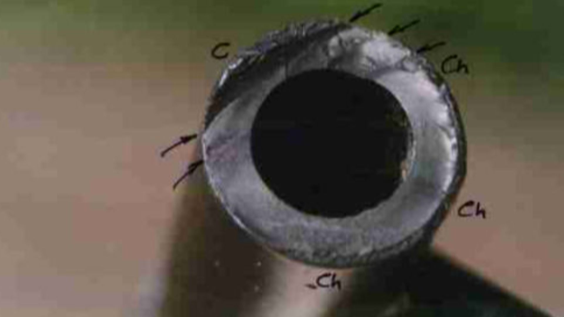 This nylon broken fuel pipe caused a serious accident when diesel fuel poured out from a van onto the road. A following car skidded and the driver was seriously injured when she collided with an oncoming lorry. Scanning electron microscopy or SEM showed that the nylon connector had fractured by stress corrosion cracking (SCC) due to a small leak of battery acid.