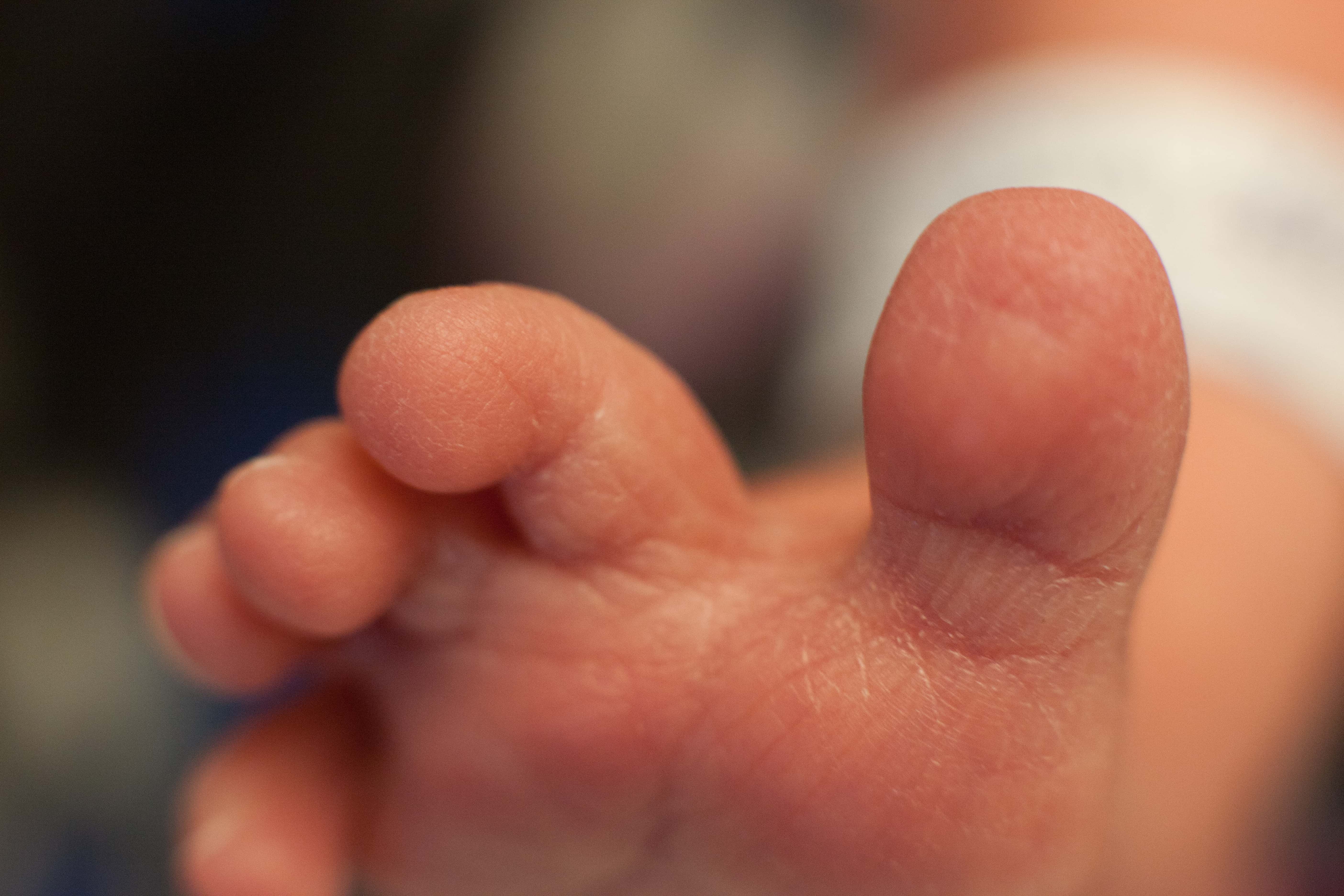 Close-up photo of a baby big toe