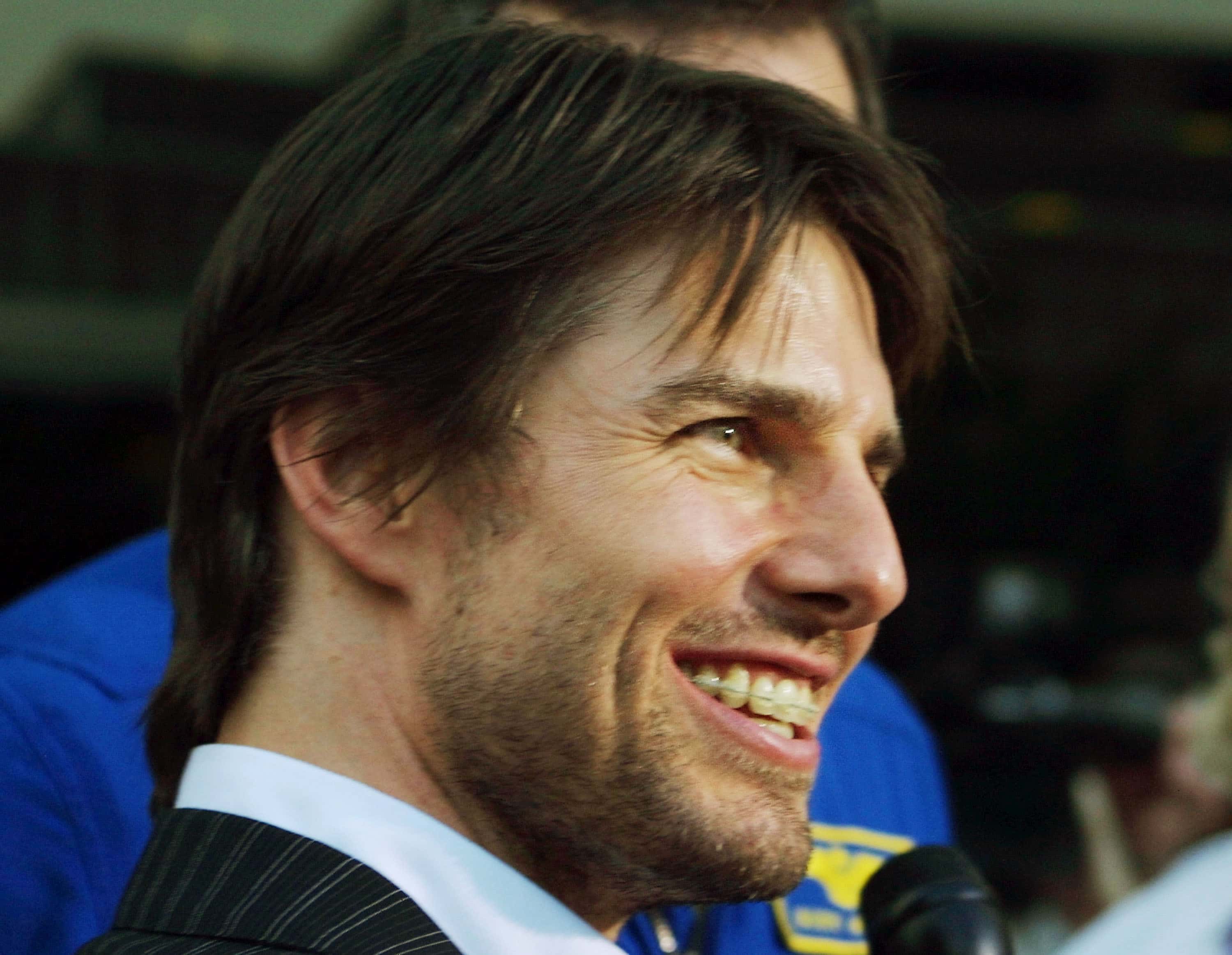 Actor Tom Cruise, wearing braces
