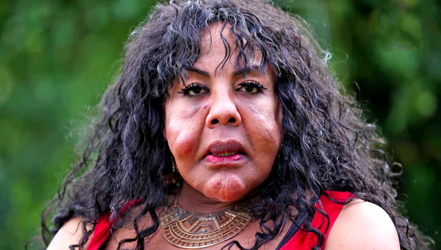  Plastic Surgery facts 