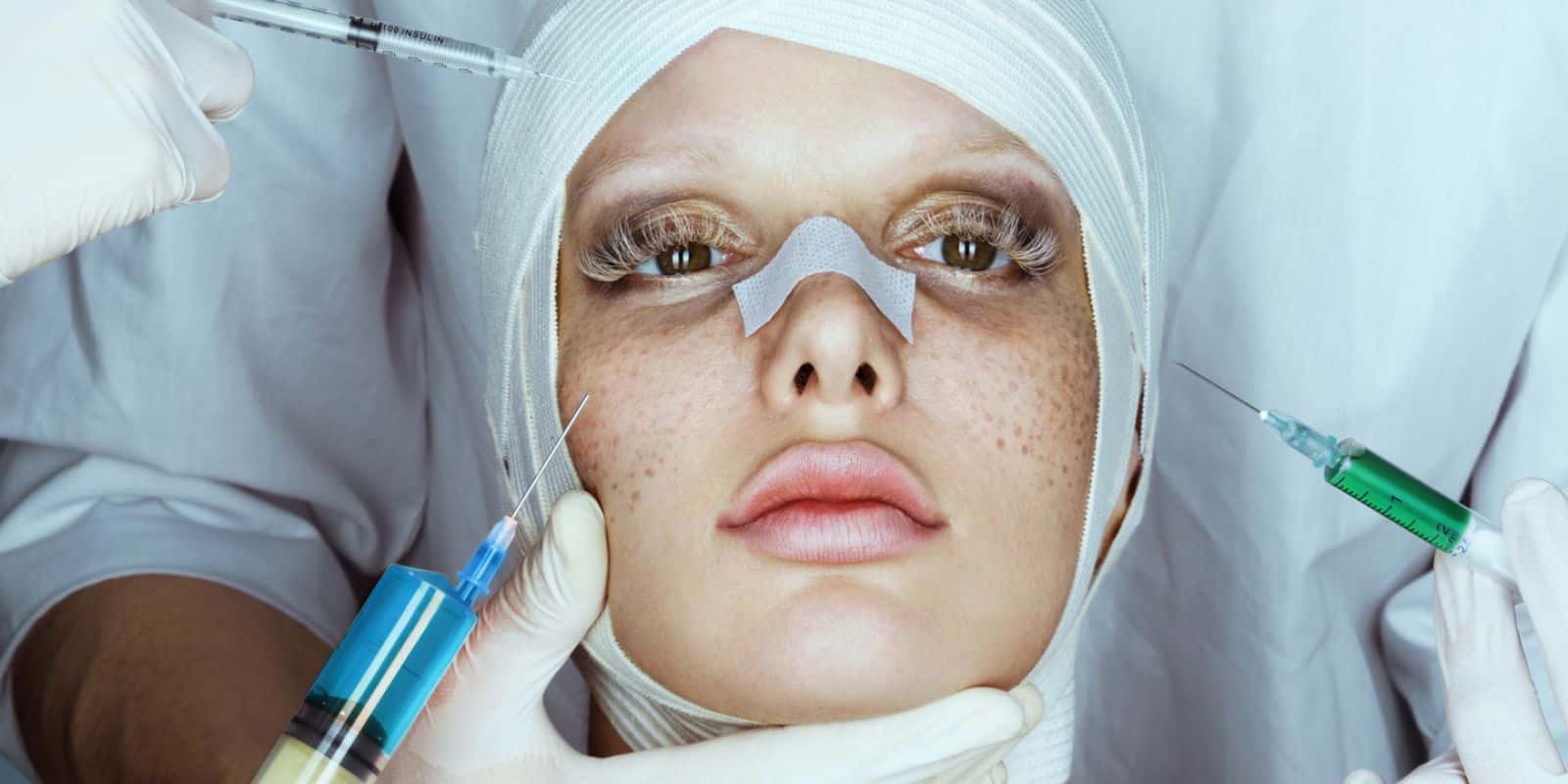  Plastic Surgery facts 