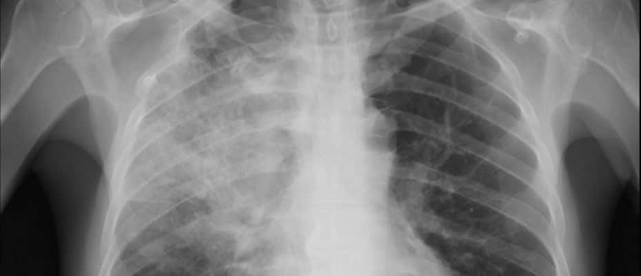 Franklin Expedition facts