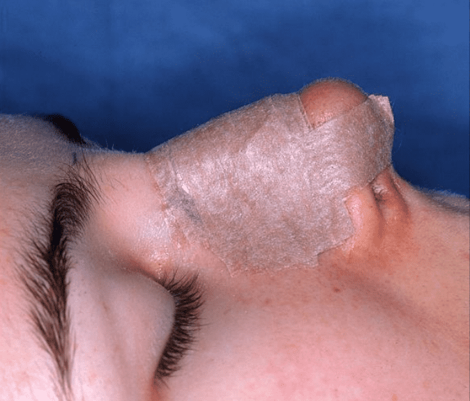 Plastic Surgery Facts 