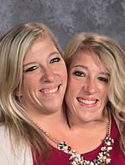 30 Interesting Things About Famous Conjoined Twins Abby And Brittany Hensel