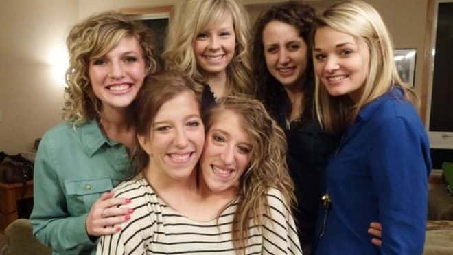 30 Interesting Things About Famous Conjoined Twins Abby And Brittany Hensel