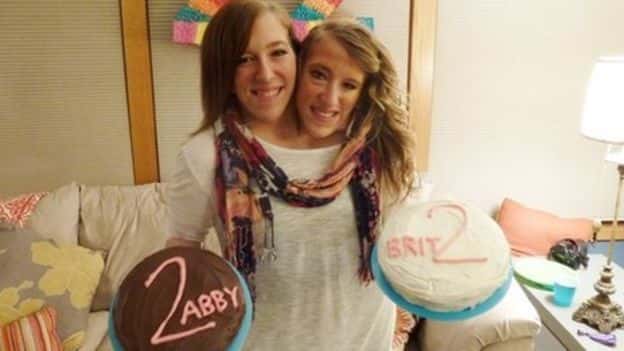 30 Interesting Things About Famous Conjoined Twins Abby And Brittany Hensel