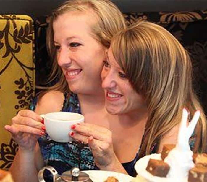30 Interesting Things About Famous Conjoined Twins Abby And Brittany Hensel
