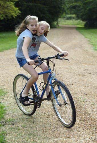30 Interesting Things About Famous Conjoined Twins Abby And Brittany Hensel