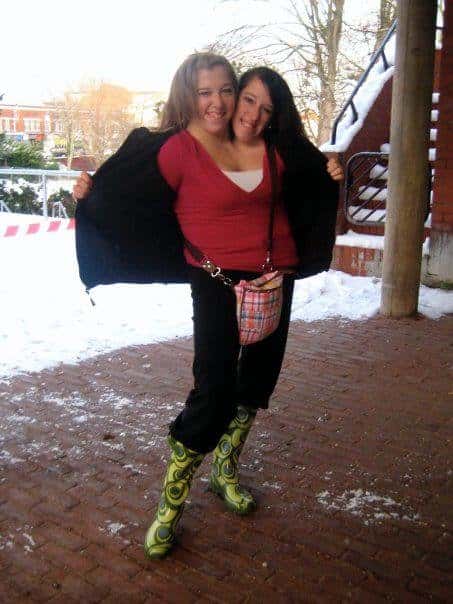 30 Interesting Things About Famous Conjoined Twins Abby And Brittany Hensel