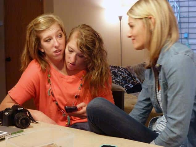 30 Interesting Things About Famous Conjoined Twins Abby And Brittany Hensel