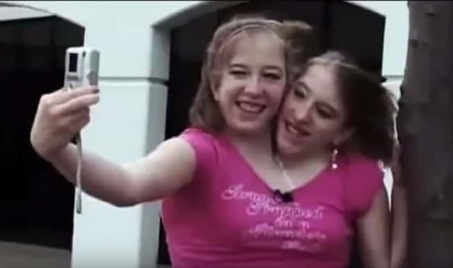30 Interesting Things About Famous Conjoined Twins Abby And Brittany Hensel