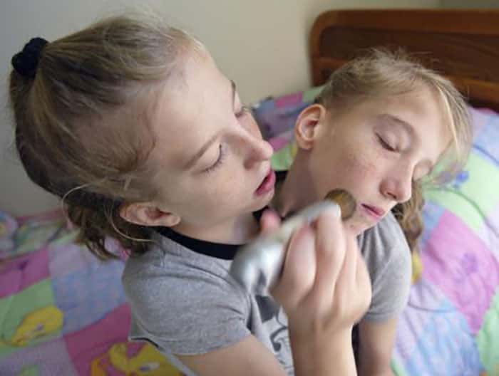 30 Interesting Things About Famous Conjoined Twins Abby And Brittany Hensel