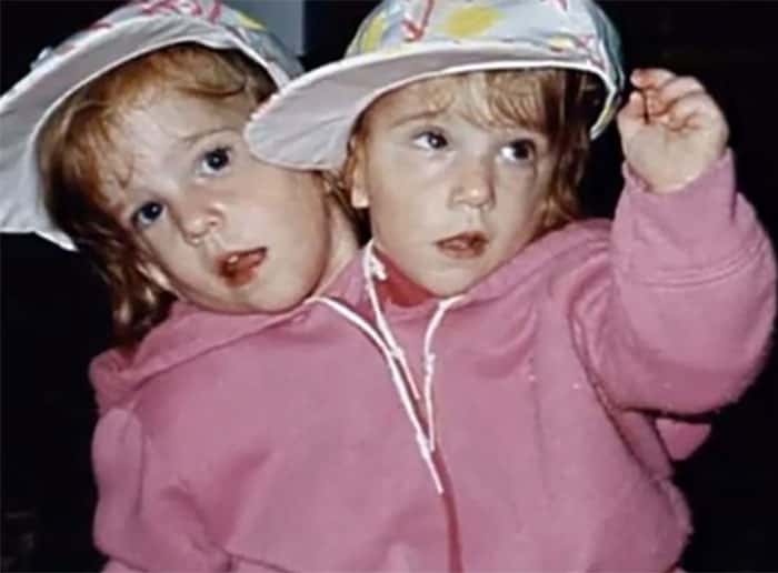 30 Interesting Things About Famous Conjoined Twins Abby And Brittany Hensel