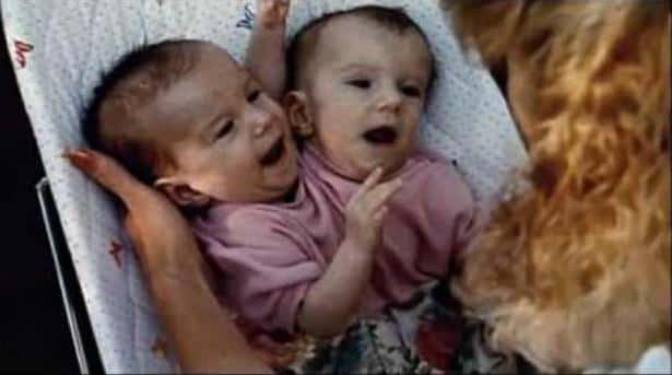 their own separate sets of vital organs. While Abby and Brittany each have their own heart, stomach, and lungs, they share a common reproductive system—meaning that surgery to separate them would be very challenging and possibly dangerous.