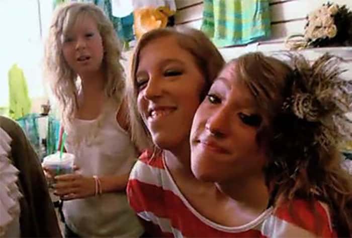30 Interesting Things About Famous Conjoined Twins Abby And Brittany Hensel