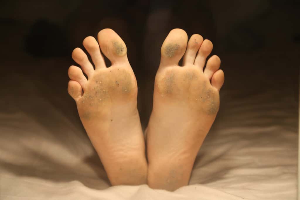 Most Disgusting Habits Facts