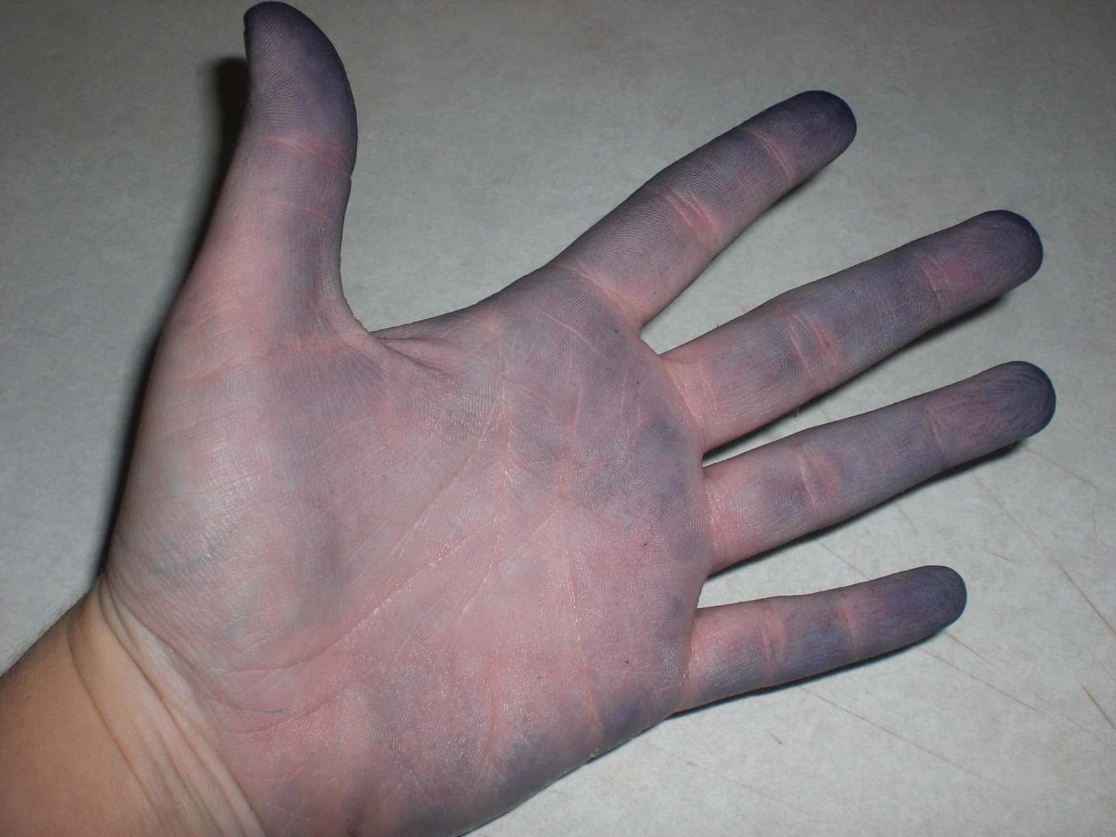 Ridiculous Patients facts