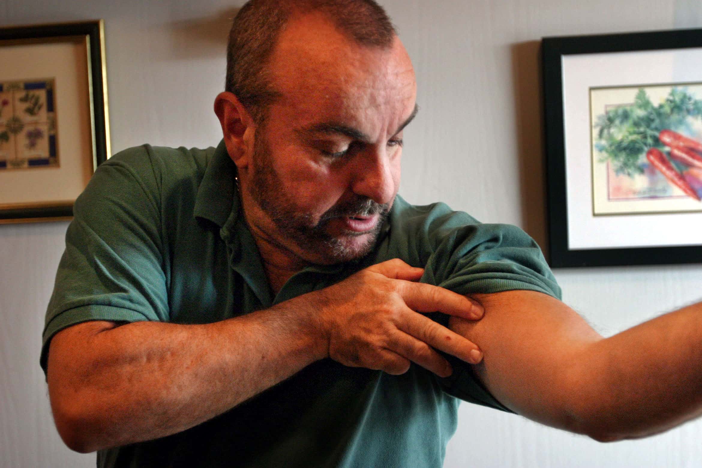 Middle aged man showing scars of DC sniper.