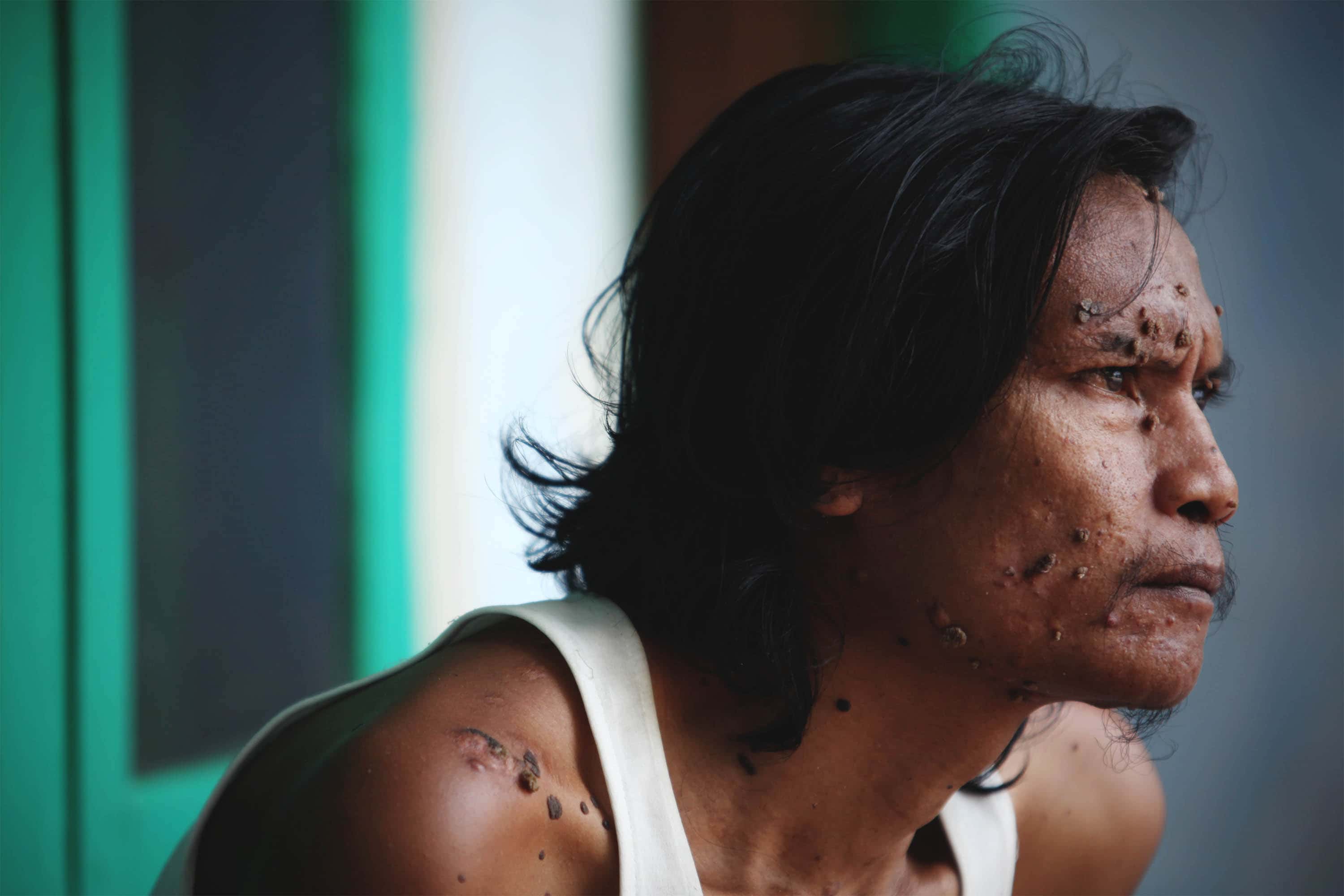 Bizarre People facts