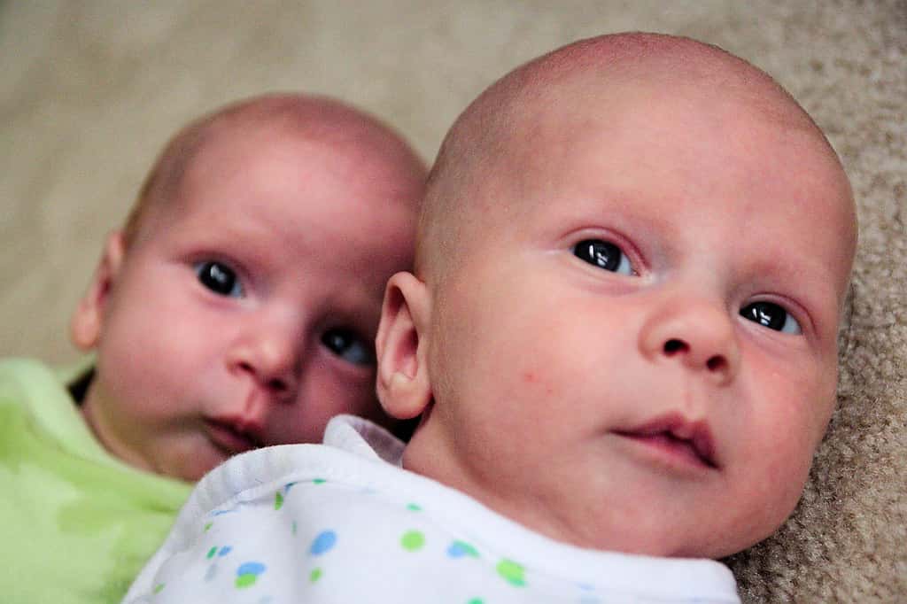 Identical Twin Stories Facts