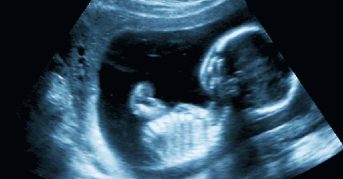 Why Do Men Have Nipples?