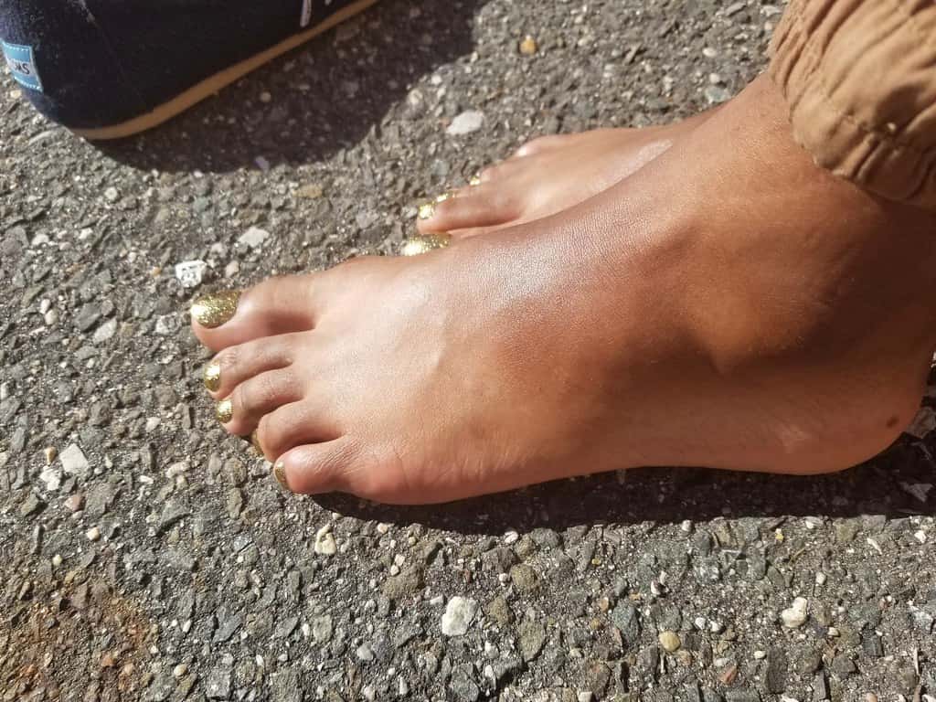 Dumbest Ways They’ve Hurt Themselves Facts