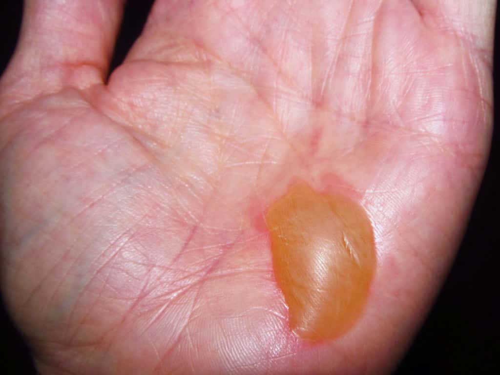 Everyday mistakes Facts