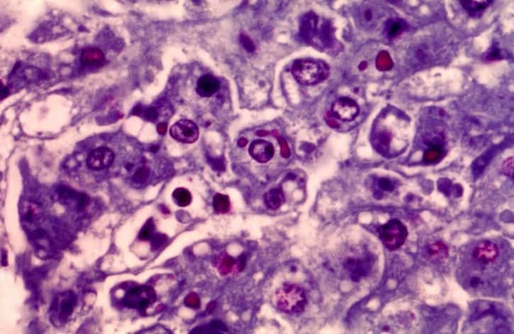 Awkward Halloween Facts