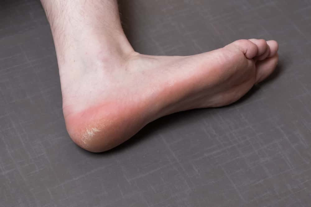 Unromantic Moments Facts