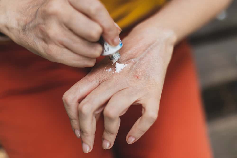 Best Arthritis Creams