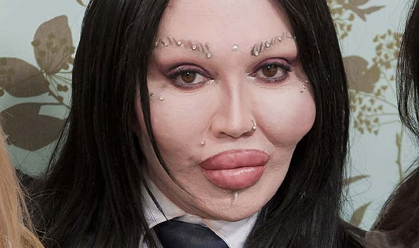 Pete Burns Facts