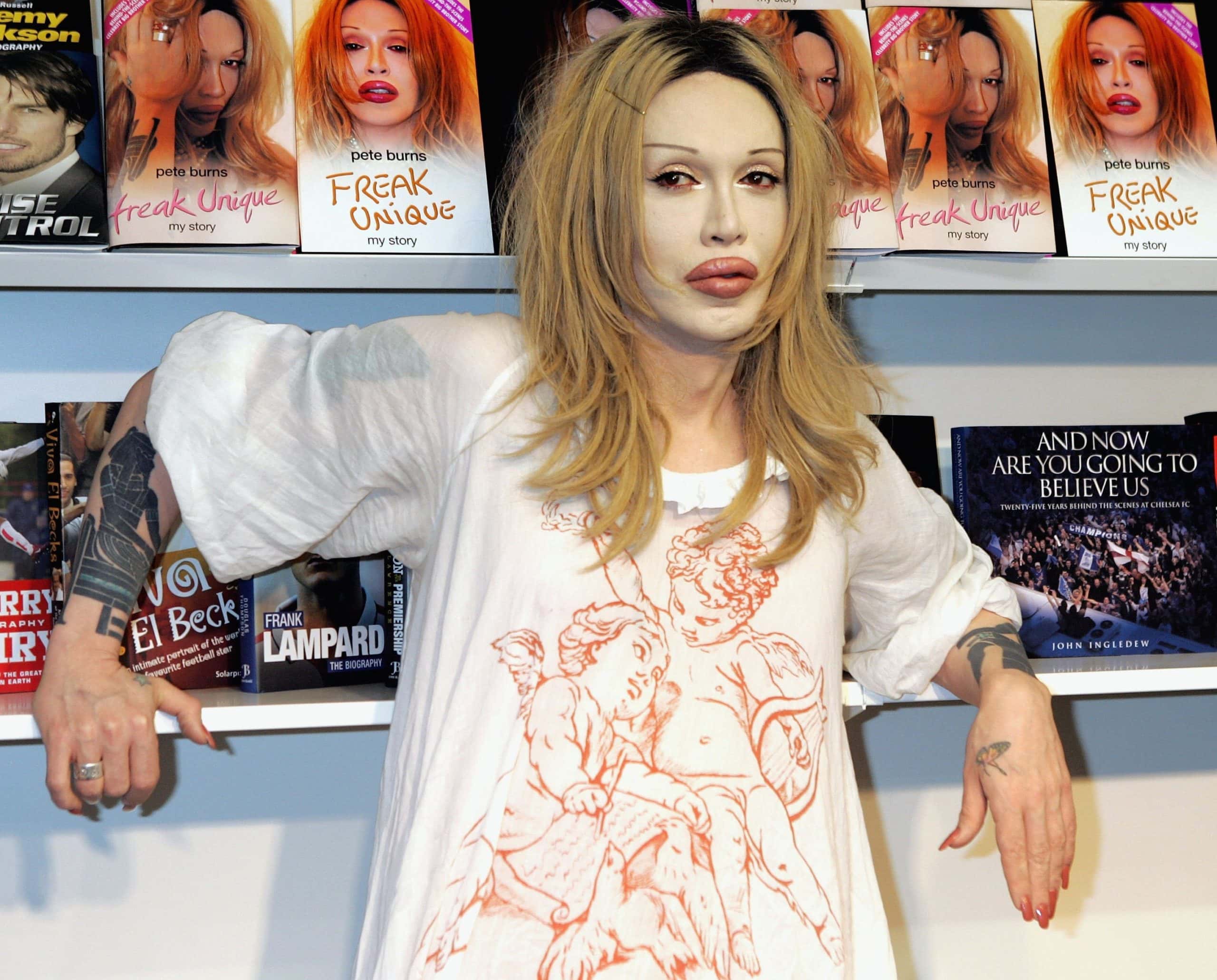 Pete Burns Facts