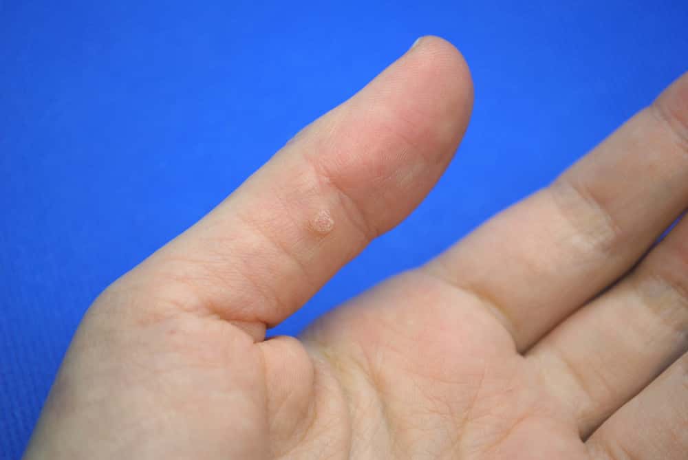 Doctor's Second Opinion