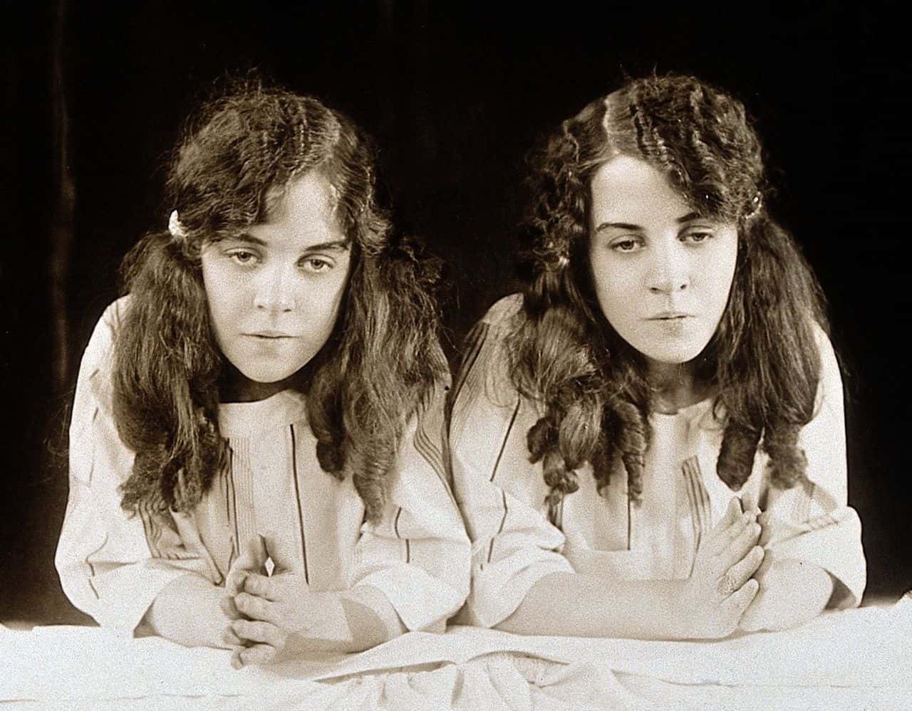 Daisy and Violet Hilton facts