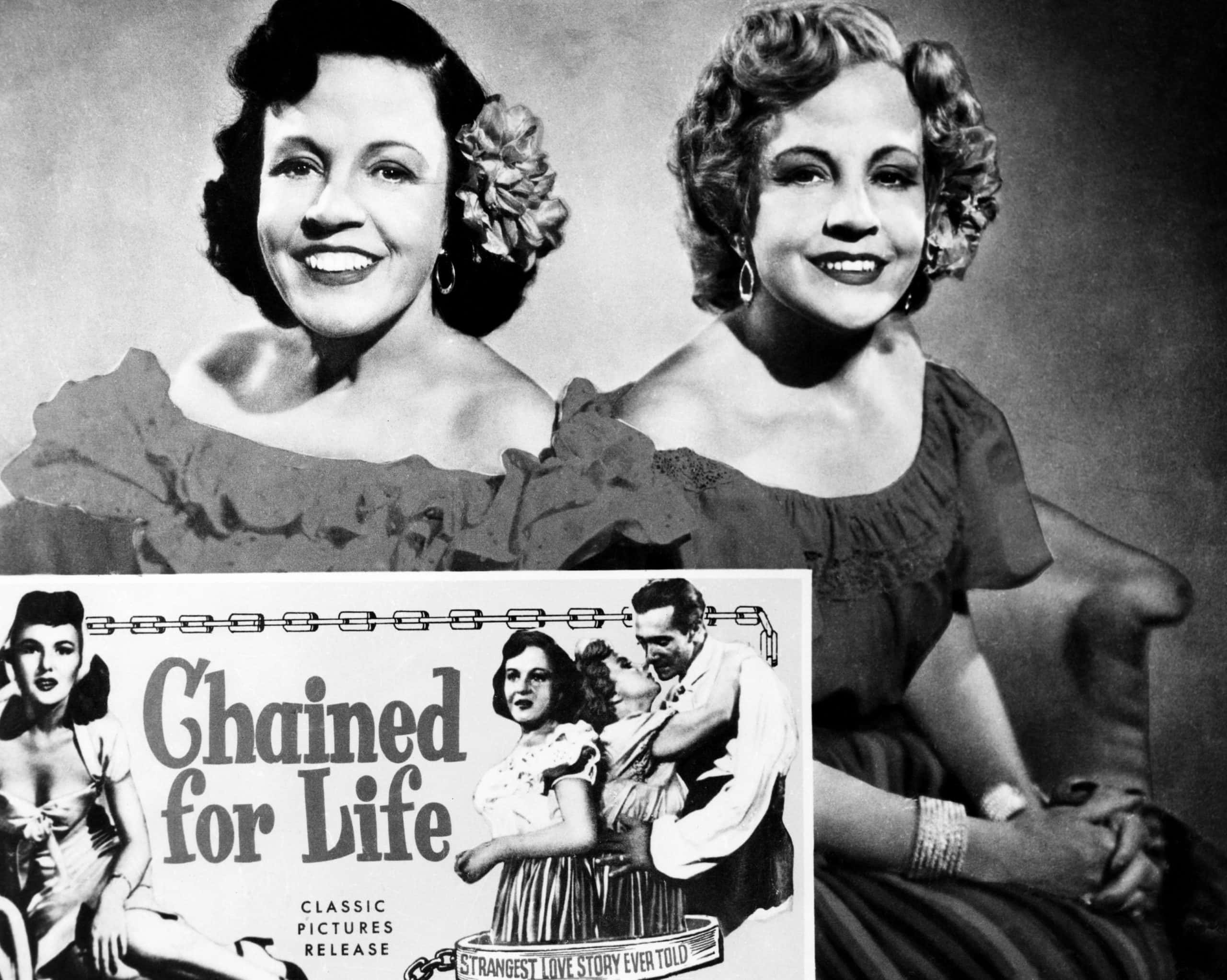 Daisy and Violet Hilton facts