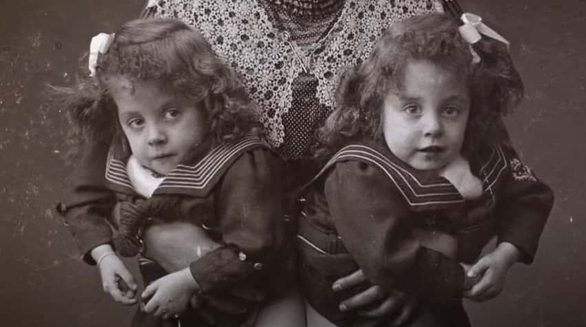 Daisy and Violet Hilton facts