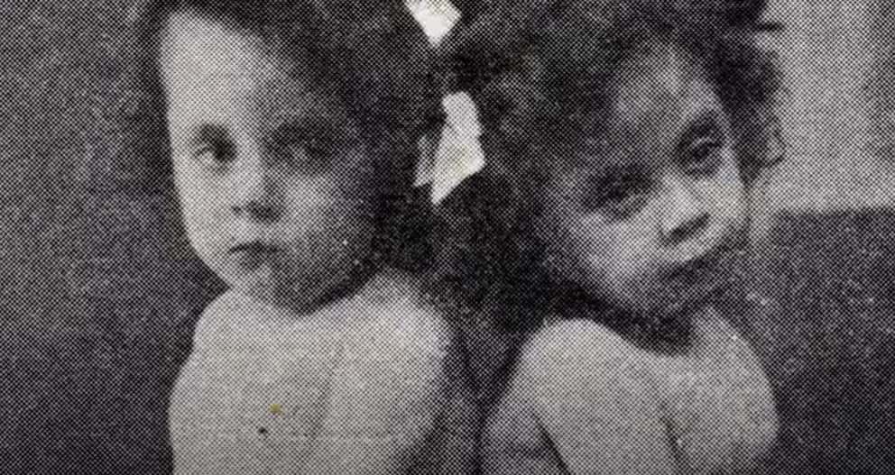 Daisy and Violet Hilton facts