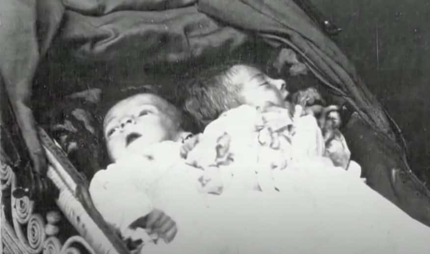 Daisy and Violet Hilton facts