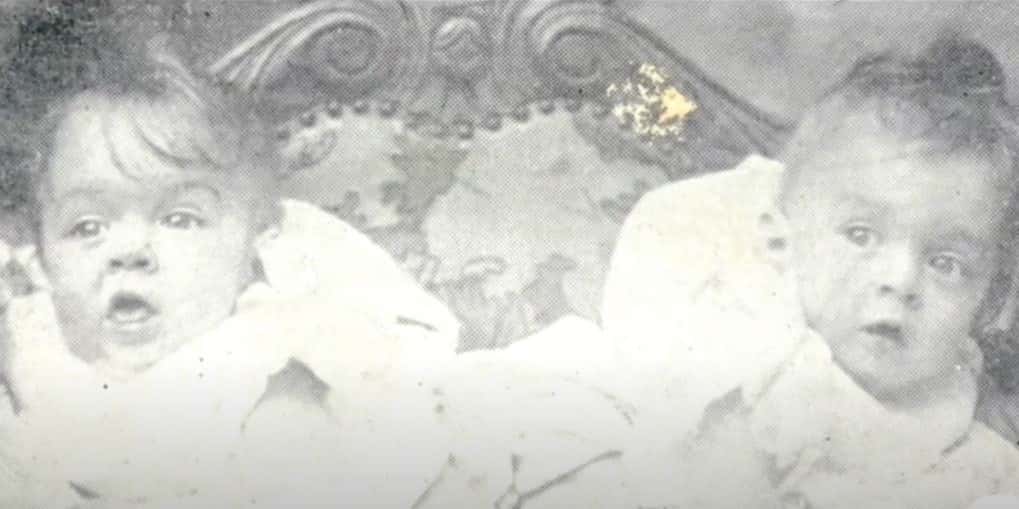 Daisy and Violet Hilton facts