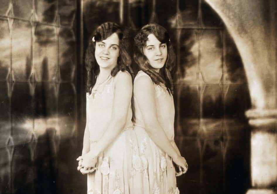 Daisy and Violet Hilton facts