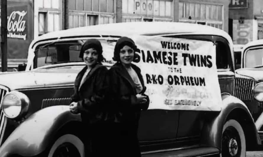 Daisy and Violet Hilton facts