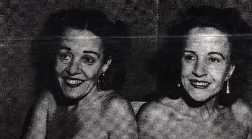 Daisy and Violet Hilton facts