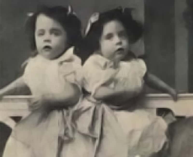 Daisy and Violet Hilton facts