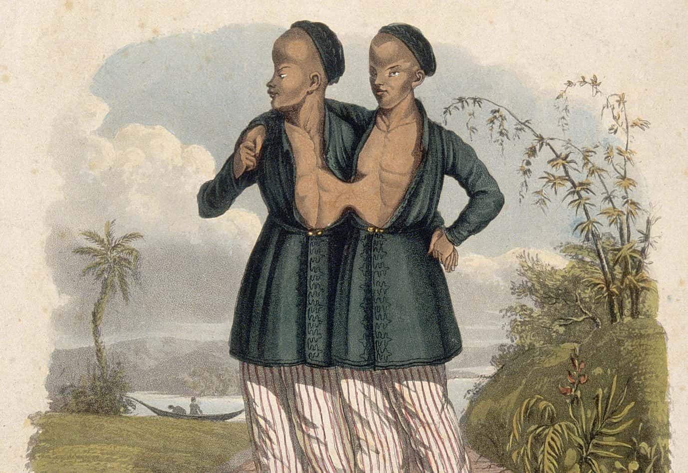 Chang and Eng Bunker facts