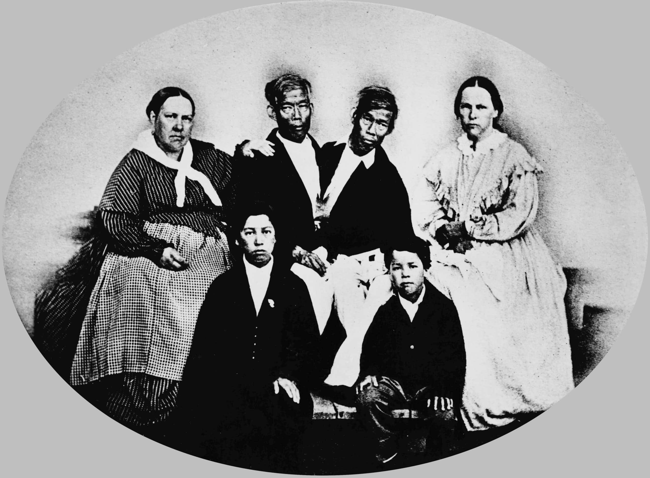 Chang and Eng Bunker facts