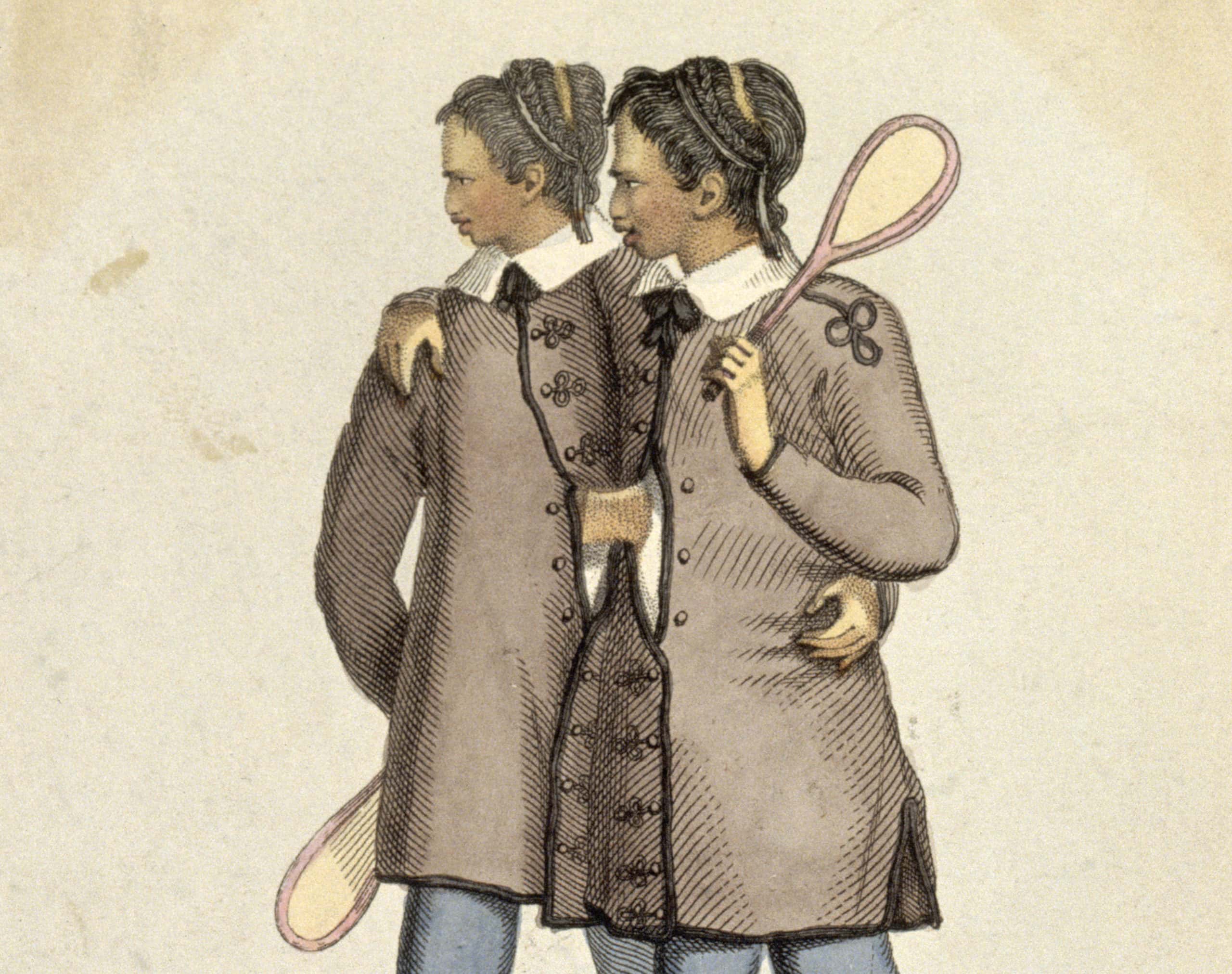 Chang and Eng Bunker facts