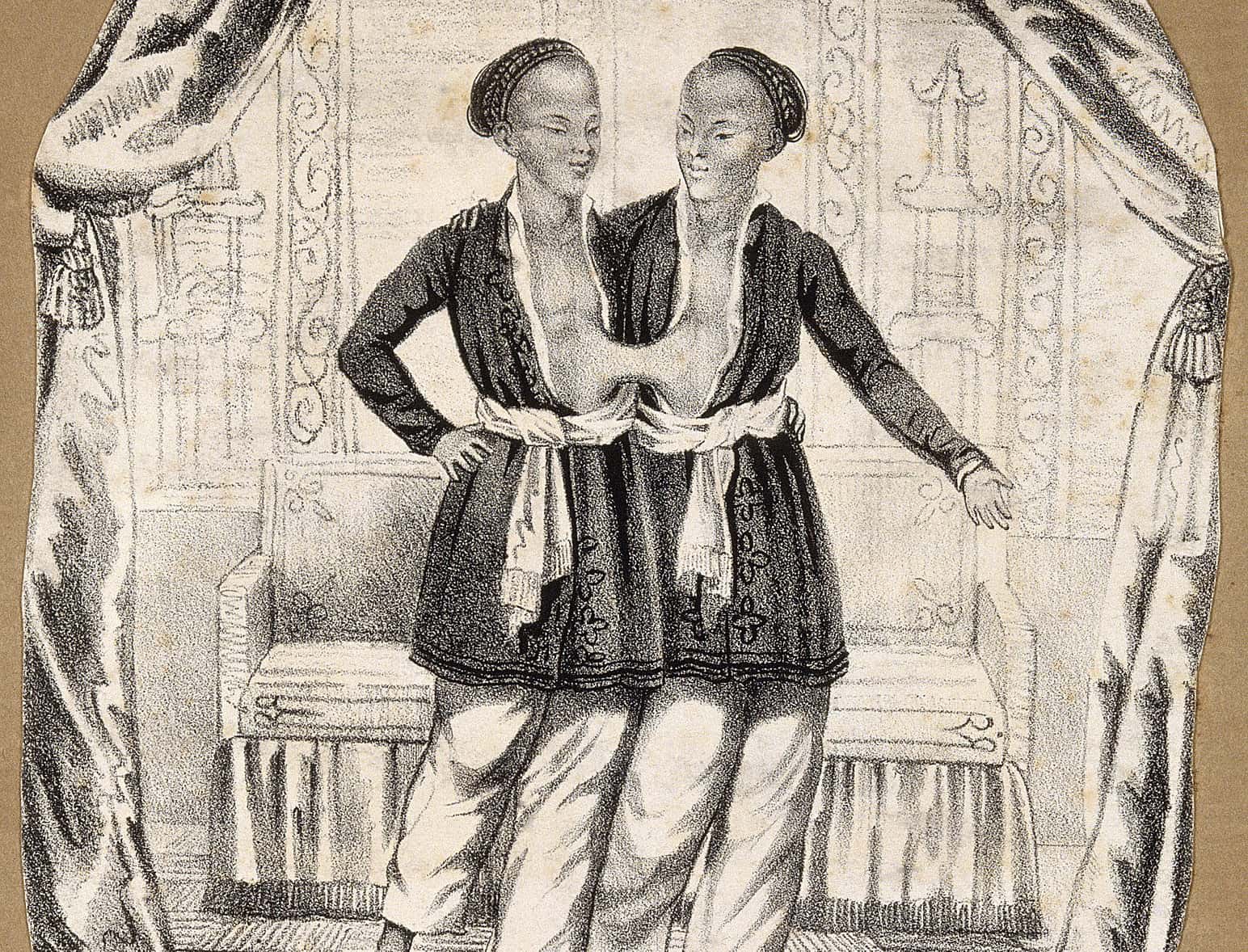 Chang and Eng Bunker facts