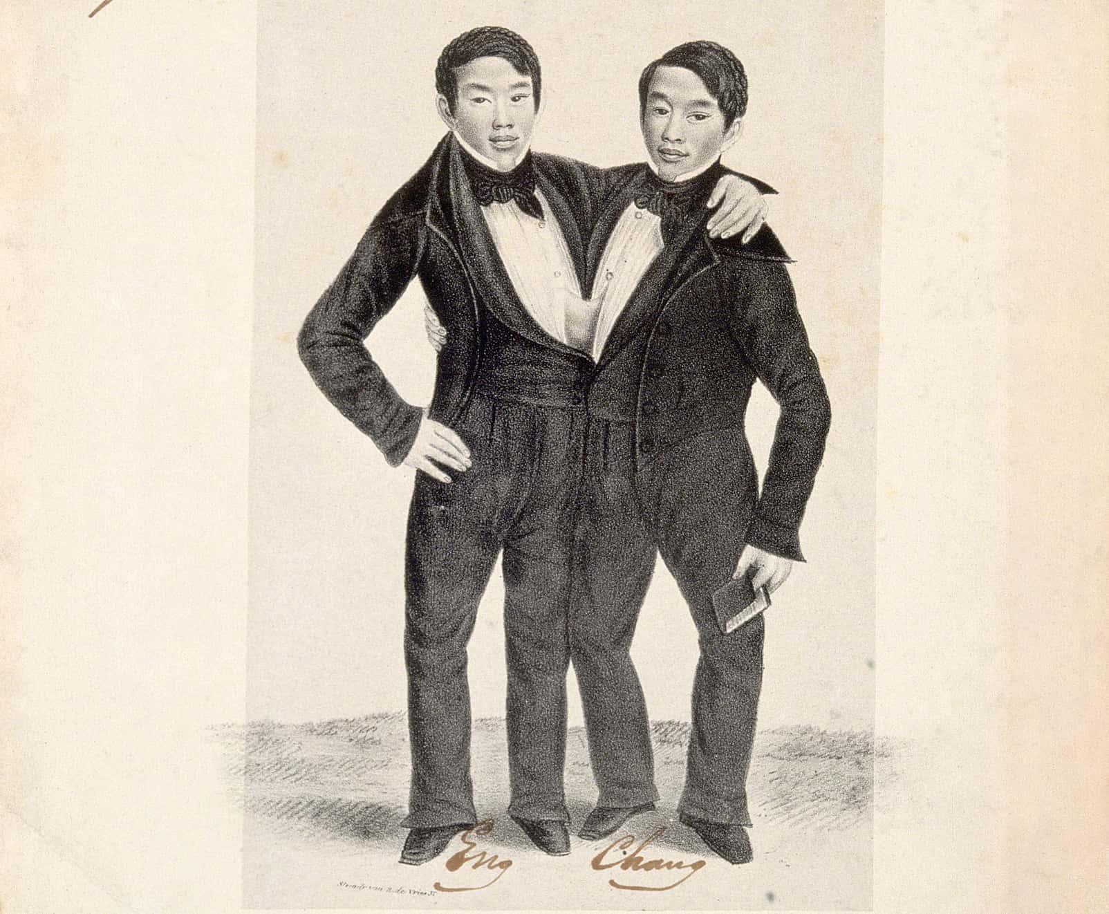 Chang and Eng Bunker facts