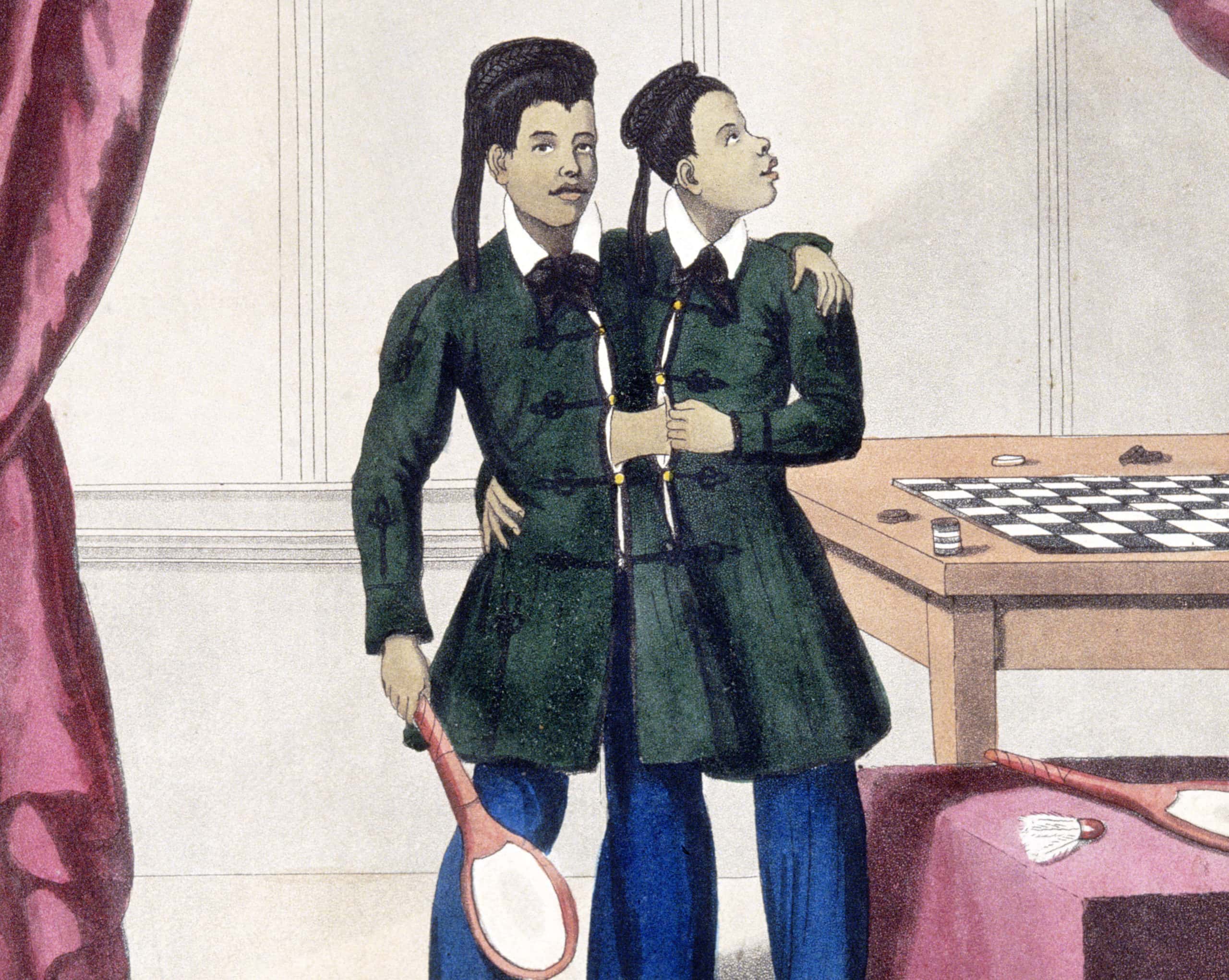 Chang and Eng Bunker facts